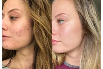 Лилия Петрова